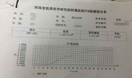 郑州市肝病医院治疗乙肝吗