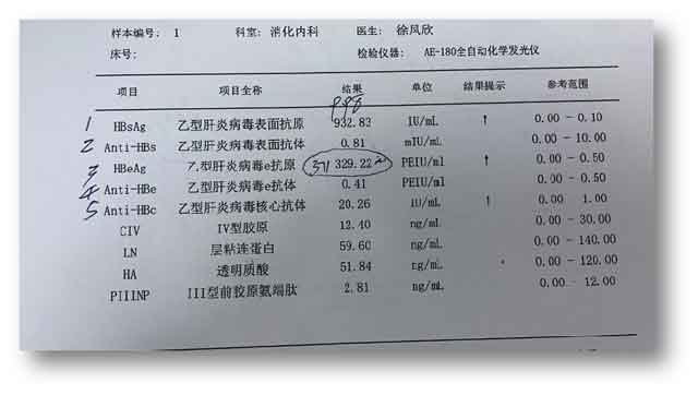 乙肝大三阳去郑州哪个医院好?郑州肝脏科哪个医院好