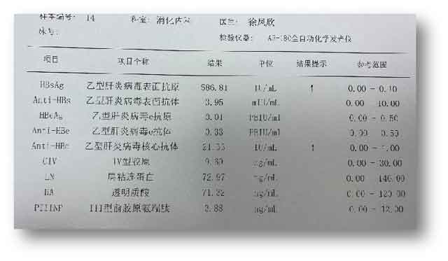 乙肝大三阳去郑州哪个医院好?郑州肝脏科哪个医院好