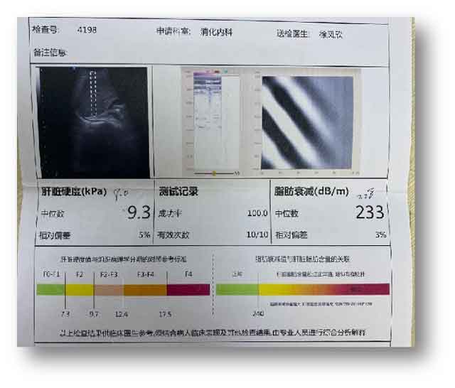 乙肝大三阳去郑州哪个医院好?郑州肝脏科哪个医院好